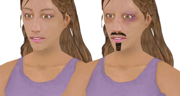 retexturing skin
